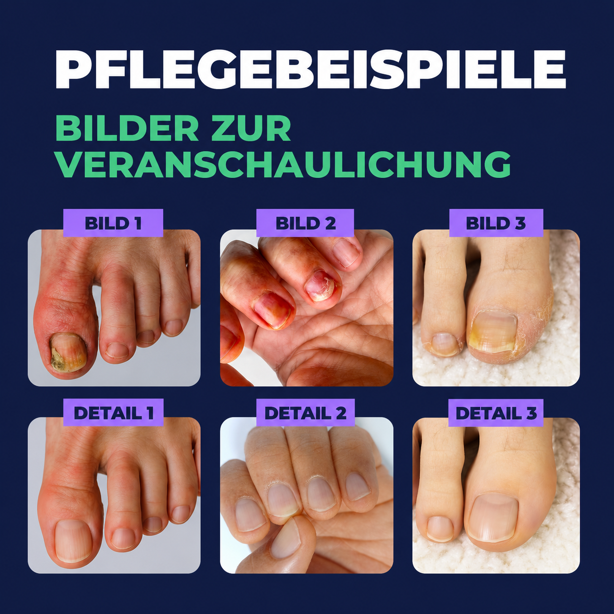 2 Stück Nagelpflegestift – Kosmetische Pflege für Nägel & Nagelhaut | Gepflegtes, optisches Erscheinungsbild | Nagelpflegestift für den täglichen Gebrauch